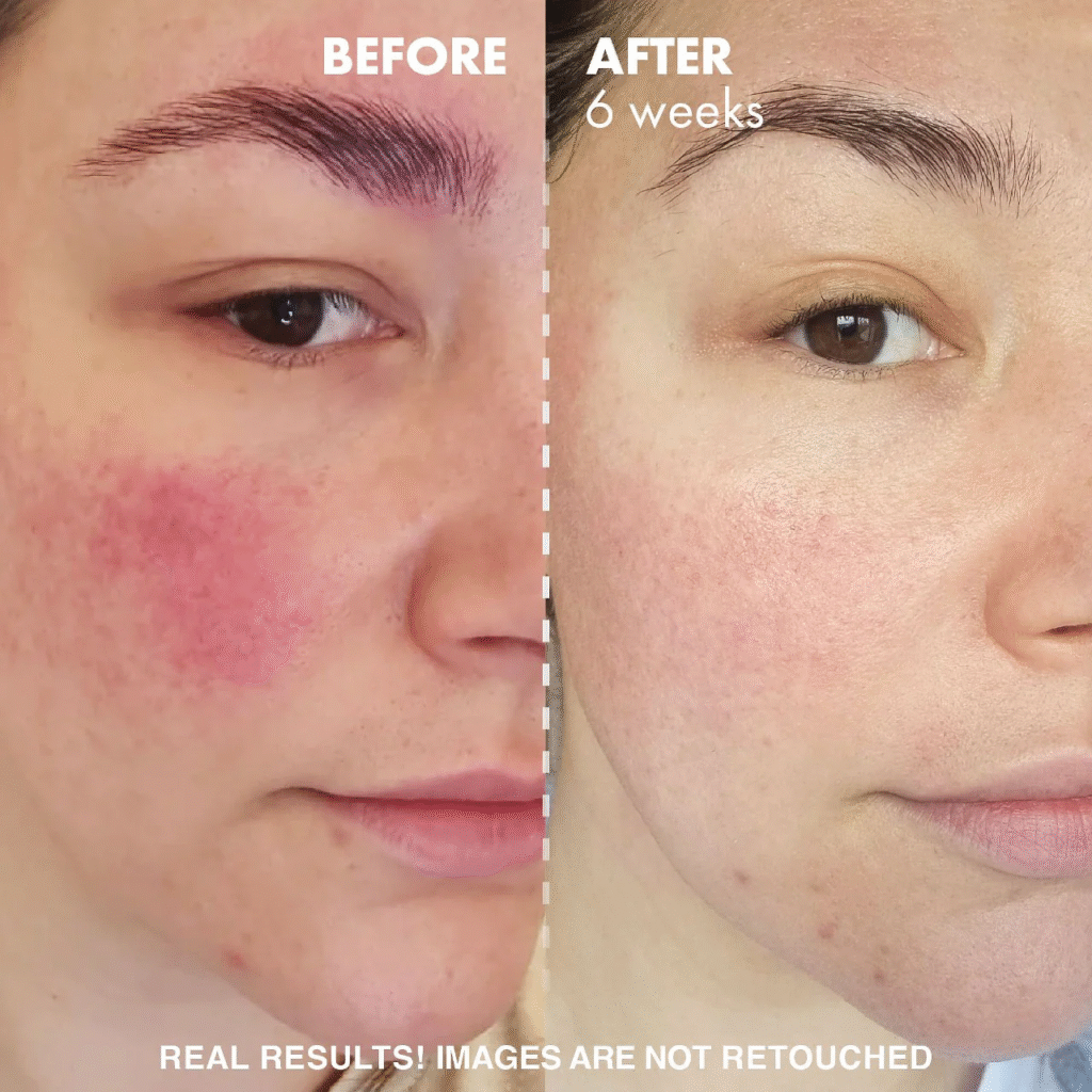 Sea Moss for Skin Before and After